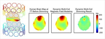 Left: a figure of a head surrounded by multi-colored circular coil rings Right: Three images of a brain scan labeled "Human Brain Map at 7T Before Shimming", "Dynamic Multi-Coil Magnetic Field Modeling", and "Dynamic Multi-Coil Shimming Result"
