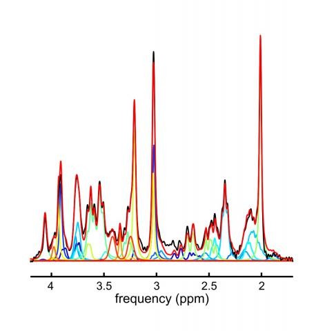 MR Spectroscopy Basis Sets