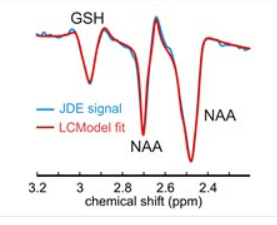 MR Spectroscopy Towards In Vivo Metabolomics of Multiple Sclerosis An image of a metabolite spectrum