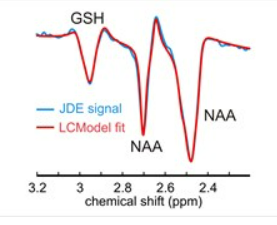 An image of a metabolite spectrum