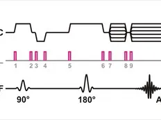 An image of an MRI pulse sequence
