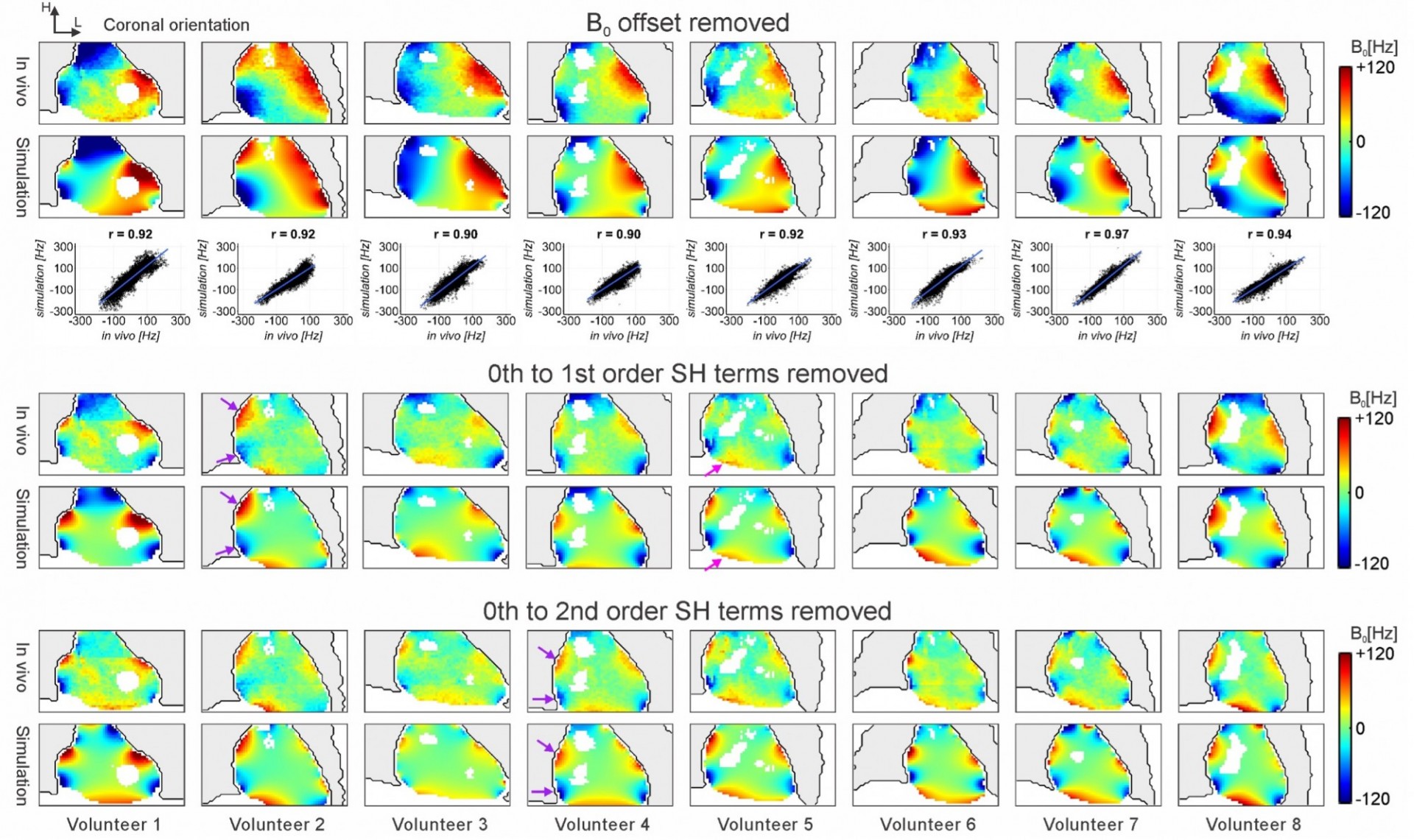 Figure 1. Comparison of simulated field maps and in vivo measurements of 8 volunteers shown at the end of the diastolic phase. B0 fields are presented with B0 offset removed, 0th to 1st order SH terms removed, 0th to 2nd order SH terms removed, respectively and surrounded by the segmented lung structures (grey regions with black profiles). Flow artifacts were removed (white regions) and disregarded in the field analysis. Both groups show a high-degree similarity with a strong average correlation between simulations and in vivo measurements of B0 magnetic field distributions and consistent locations of local B0 inhomogeneities (see arrows). Figure 1