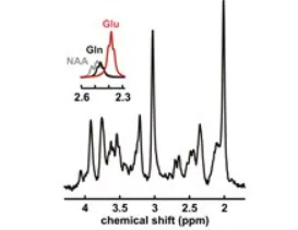 A metabolite spectrum