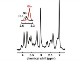 In Vivo Pathobiochemical Profiling of Neurological Conditions A metabolite spectrum